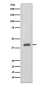 CSNK2A1 alpha Rabbit mAb ABZ5010