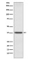 OTX1 Rabbit mAb ABZ5012