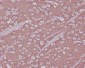Synaptophysin Rabbit mAb ABZ5014