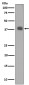 Synaptophysin Rabbit mAb ABZ5014