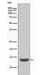Histone H2A.X Rabbit mAb ABZ5015