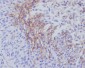 Thrombomodulin Rabbit mAb ABZ5016
