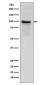 Thrombomodulin Rabbit mAb ABZ5016