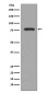 PKC beta 2 Rabbit mAb ABZ5021