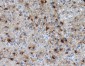GFAP Rabbit mAb ABZ5022