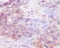 Human IgG4 Rabbit mAb ABZ5023