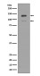 Interferon alpha/beta Receptor 1 Rabbit mAb ABZ5024