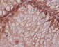 Integrin beta 1 Rabbit mAb ABZ5025