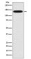 Integrin beta 1 Rabbit mAb ABZ5025