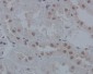 IRF1 Rabbit mAb ABZ5028