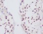 Fibrillarin Rabbit mAb ABZ5029
