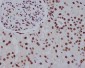 Histone H2A Rabbit mAb ABZ5030
