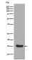 Midkine Rabbit mAb ABZ5036
