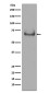 Lamin B Receptor Rabbit mAb ABZ5037