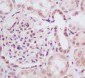 SUMO Conjugating Enzyme UBC9 Rabbit mAb ABZ5040