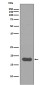 SUMO Conjugating Enzyme UBC9 Rabbit mAb ABZ5040