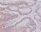 CD3 epsilon Rabbit mAb ABZ5041