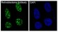 Rb Rabbit mAb ABZ5045