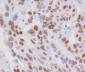 Rb Rabbit mAb ABZ5045