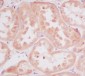 RPS20 Rabbit mAb ABZ5046