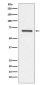 ANGPT1 Rabbit mAb ABZ5048