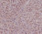 Asparagine Synthetase Rabbit mAb ABZ5049