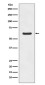 Asparagine Synthetase Rabbit mAb ABZ5049