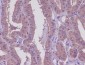 MEKK2 Rabbit mAb ABZ5050