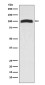 VAV2 Rabbit mAb ABZ5051