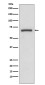 Cyclooxygenase 1 Rabbit mAb ABZ5052