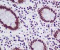 Topoisomerase I Rabbit mAb ABZ5053