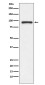 Topoisomerase I Rabbit mAb ABZ5053