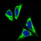 TNFAIP3 Rabbit mAb ABZ5054