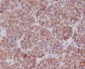 TNFAIP3 Rabbit mAb ABZ5054