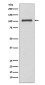INPP4B Rabbit mAb ABZ5055