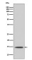 Histone H2B Rabbit mAb ABZ5060