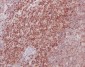 MEK3/MEK6 Rabbit mAb ABZ5061