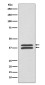 MEK3/MEK6 Rabbit mAb ABZ5061