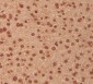 MEK3 Rabbit mAb ABZ5062