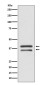MEK3 Rabbit mAb ABZ5062
