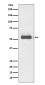 TFG Rabbit mAb ABZ5064