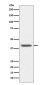 HDAC8 Rabbit mAb ABZ5065
