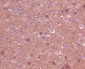 Trk Rabbit mAb ABZ5068