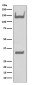 Trk Rabbit mAb ABZ5068