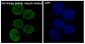 Ubiquitin K48 Rabbit mAb ABZ5070