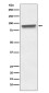 Mitofilin Rabbit mAb ABZ5073