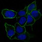 Integrin alpha 5 Rabbit mAb ABZ5074