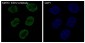 KMT6/EZH2 Rabbit mAb ABZ5075