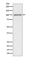 KMT6/EZH2 Rabbit mAb ABZ5075