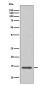 Cystatin C Rabbit mAb ABZ5077